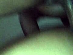 Doctor applies chocolate glaze to patient in hospital.