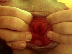 vacuum sucks my prolapsed anal lips jerkoff